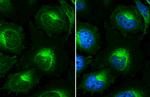 beta-2 Microglobulin Antibody in Immunocytochemistry (ICC/IF)