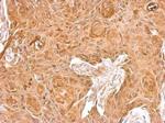 beta-2 Microglobulin Antibody in Immunohistochemistry (Paraffin) (IHC (P))