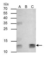 beta-2 Microglobulin Antibody in Immunoprecipitation (IP)