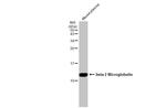 beta-2 Microglobulin Antibody in Western Blot (WB)