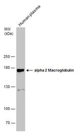 A2M Antibody in Western Blot (WB)