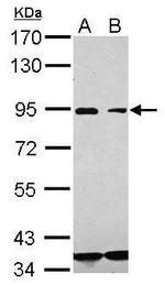 CD36 Antibody in Western Blot (WB)