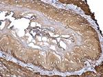 Filamin A alpha-2 Antibody in Immunohistochemistry (Paraffin) (IHC (P))