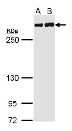 Filamin A alpha-2 Antibody in Western Blot (WB)