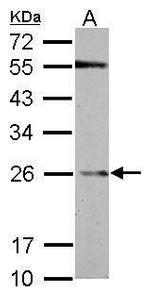 GSTP1 Antibody in Western Blot (WB)