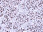 HMGB1 Antibody in Immunohistochemistry (Paraffin) (IHC (P))