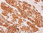 Cytokeratin 8 Antibody in Immunohistochemistry (Paraffin) (IHC (P))