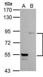 PI3K p85 alpha Antibody in Western Blot (WB)