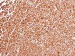 TLR3 Antibody in Immunohistochemistry (Paraffin) (IHC (P))