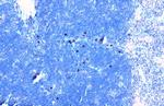 TLR3 Antibody in Immunohistochemistry (Paraffin) (IHC (P))