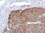 TRAF6 Antibody in Immunohistochemistry (Paraffin) (IHC (P))