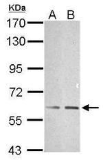 TRAF6 Antibody in Western Blot (WB)