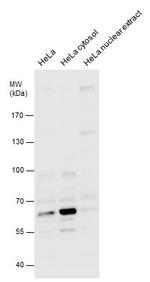 cIAP2 Antibody in Western Blot (WB)