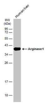 Arginase 1 Antibody in Western Blot (WB)