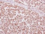 SERPINC1 Antibody in Immunohistochemistry (Paraffin) (IHC (P))