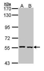 Catalase Antibody in Western Blot (WB)