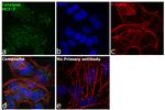 Catalase Antibody in Immunocytochemistry (ICC/IF)