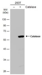 Catalase Antibody in Western Blot (WB)