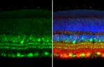 ChAT Antibody in Immunohistochemistry (Paraffin) (IHC (P))