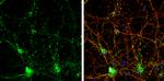 ChAT Antibody in Immunocytochemistry (ICC/IF)