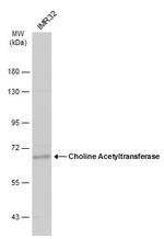 ChAT Antibody in Western Blot (WB)