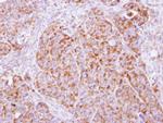 beta COP Antibody in Immunohistochemistry (Paraffin) (IHC (P))