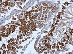 beta COP Antibody in Immunohistochemistry (Paraffin) (IHC (P))