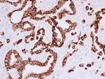 Cytokeratin 5 Antibody in Immunohistochemistry (Paraffin) (IHC (P))