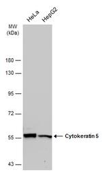 Cytokeratin 5 Antibody in Western Blot (WB)