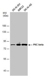 PKC beta Antibody in Western Blot (WB)