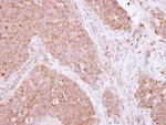 SIAH1 Antibody in Immunohistochemistry (Paraffin) (IHC (P))