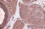 TK1 Antibody in Immunohistochemistry (Paraffin) (IHC (P))