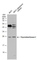 TK1 Antibody in Western Blot (WB)