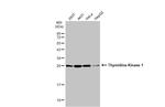 TK1 Antibody in Western Blot (WB)