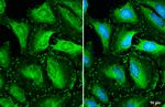 Vinculin Antibody in Immunocytochemistry (ICC/IF)