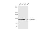 Vinculin Antibody in Western Blot (WB)