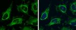 Vinculin Antibody in Immunocytochemistry (ICC/IF)