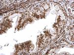 SMC1 Antibody in Immunohistochemistry (Paraffin) (IHC (P))