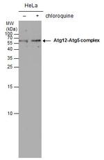 ATG5 Antibody in Western Blot (WB)