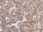 RACGAP1 Antibody in Immunohistochemistry (Paraffin) (IHC (P))