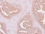 IRAK4 Antibody in Immunohistochemistry (Paraffin) (IHC (P))