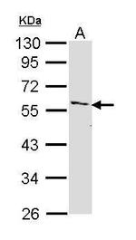 IRAK4 Antibody in Western Blot (WB)