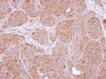 CARD11 Antibody in Immunohistochemistry (Paraffin) (IHC (P))