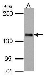 CARD11 Antibody in Western Blot (WB)