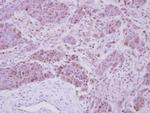 CK2 beta Antibody in Immunohistochemistry (Paraffin) (IHC (P))