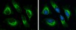 GRP78 Antibody in Immunocytochemistry (ICC/IF)