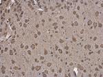 GRP78 Antibody in Immunohistochemistry (Paraffin) (IHC (P))