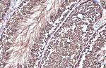 GRP78 Antibody in Immunohistochemistry (Paraffin) (IHC (P))