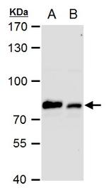 GRP78 Antibody in Western Blot (WB)