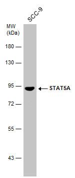 STAT5 alpha Antibody in Western Blot (WB)